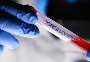 Motiv: Zwei Hände in medizinischen Handschuhen halten ein Reagenzglas mit der Aufschrift "Coronavirus". (Foto: H_Ko -stock.adobe.com)