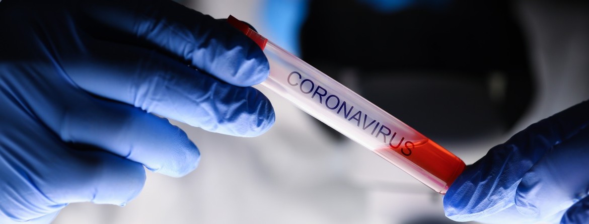 Motiv: Zwei Hände in medizinischen Handschuhen halten ein Reagenzglas mit der Aufschrift "Coronavirus". (Foto: H_Ko -stock.adobe.com)
